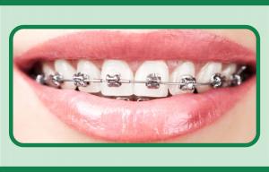 Aparelho  Auto - Ligável